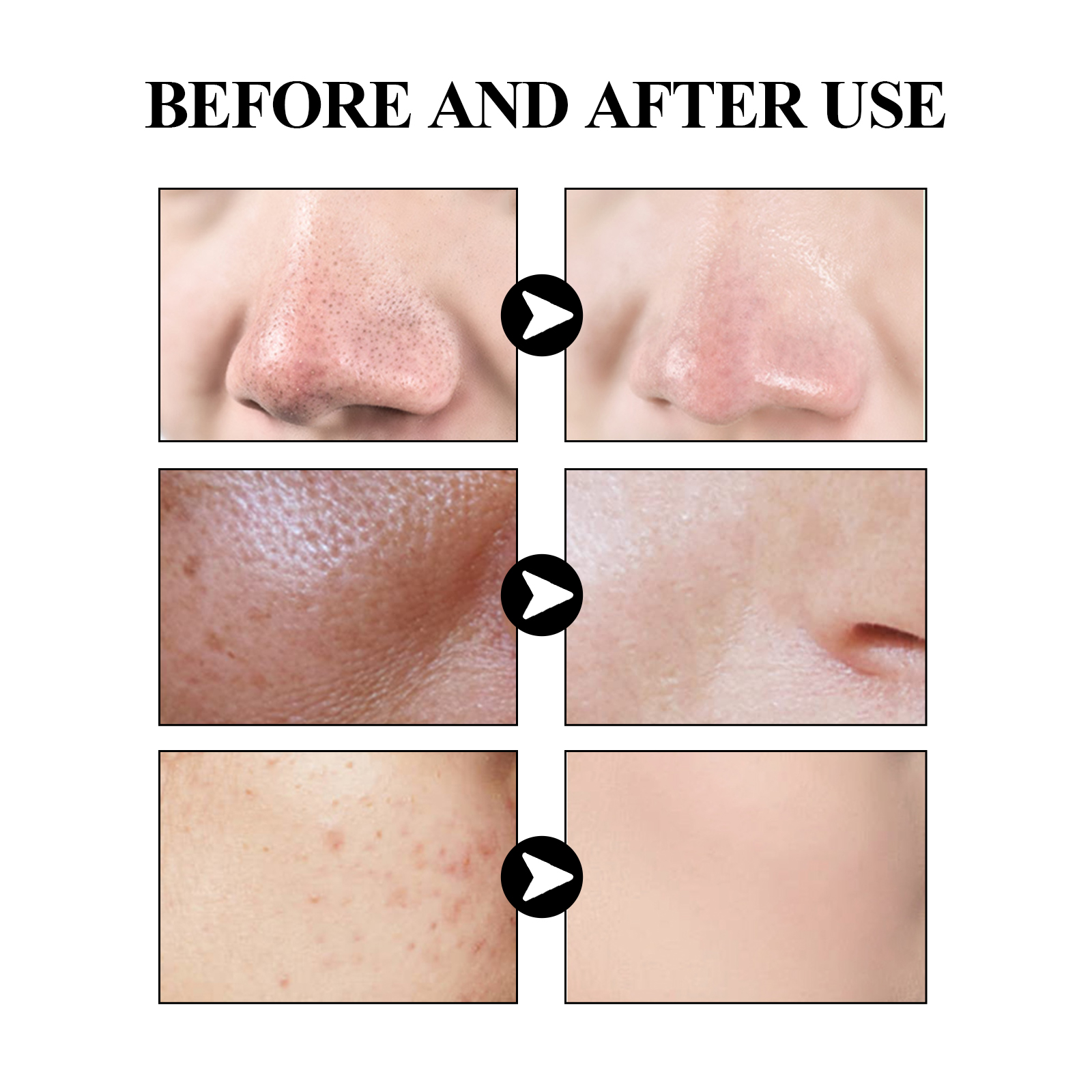 40g Activated carbon facial ma - Mud Mask Kaolin review and price