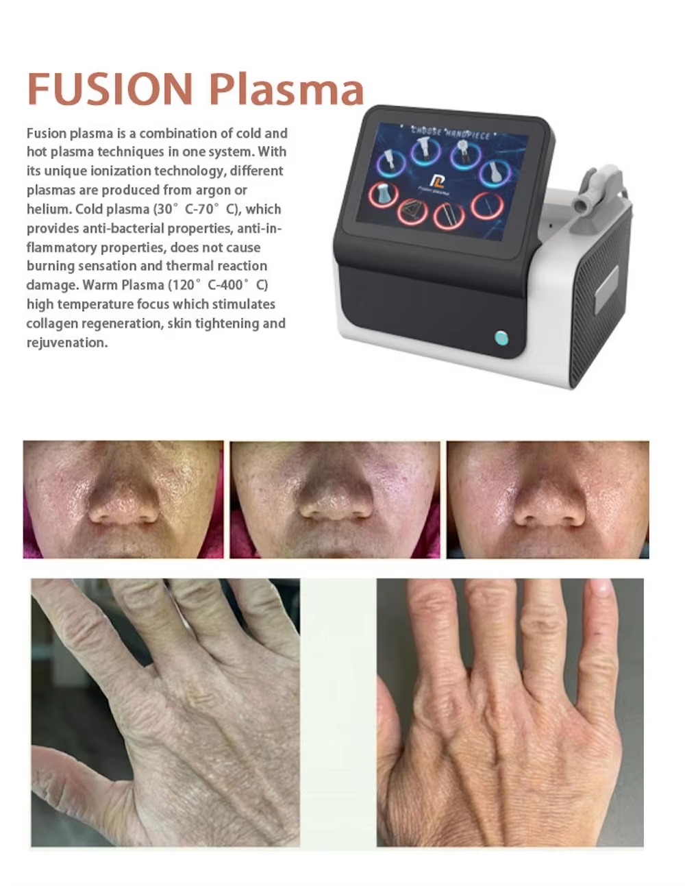 Cool Ion Beauty Device Profess - Skincare Ls review and price