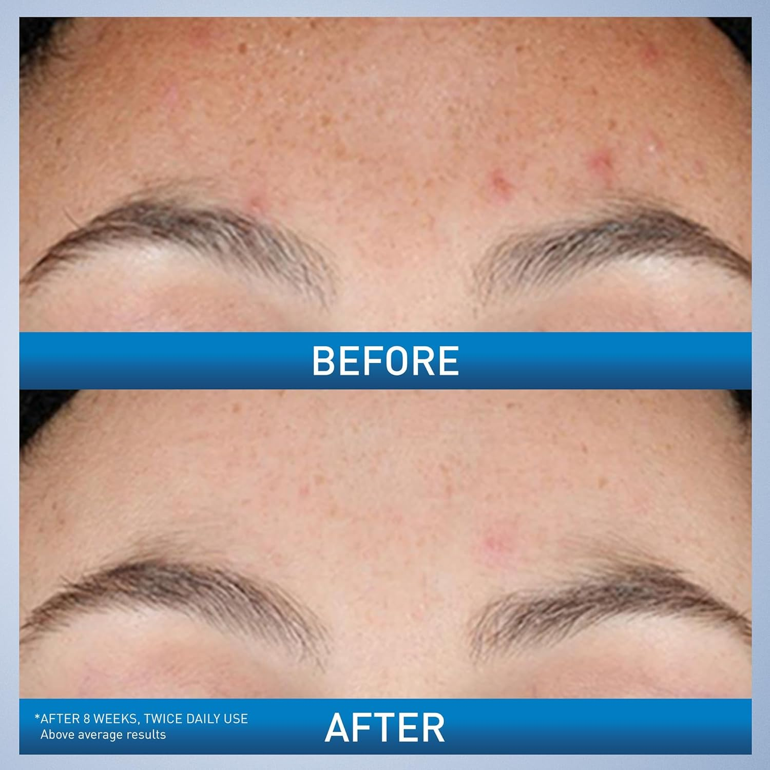 CeraVe Retinol Serum Niacinami - Skincare Non Comedogenic review and price